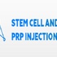 Stem Cell Treatment and PRP Injections in Bayonne, NJ Health & Medical