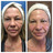 Aesthetica Med Spa of San Diego in West University Heights - San Diego, CA