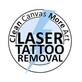 Clean Canvas More Art in Westbury, NY Tattoo Covering & Removing