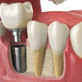 California Dental Group Tustin in Tustin, CA Dentists