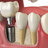 California Dental Group Tustin in Tustin, CA