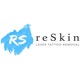 reSkin in Las Vegas, NV Tattoo Covering & Removing