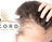 Concord Hair Restoration in Mission Valley - San Diego, CA 92108 Hair Care & Treatment