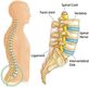 Lower Left and Right Side Back Pain in Union, NJ Chiropractor