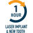 1 Hour Implants in Borough Park - Brooklyn, NY 11219 Dental Clinics