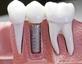 stoneybrookdental in Malden, MA Cosmetics - Medical