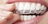 Las Vegas Invisalign in Las Vegas, NV