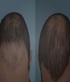 GameDay Mens Hair Replacement Newport in Newport Beach, CA Hair Replacement