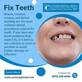 Fix Teeth in Montclair, CA Dental Certified Specialists