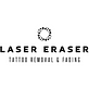 Laser Eraser: Laser Tattoo Removal in Clark, NJ Tattoo Covering & Removing