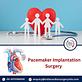 Low Cost Pacemaker Implantation Surgery India in Culver, CA Health Care Management