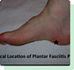 Bunion Surgery Near Me in Perth Amboy, NJ Business Services