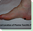 Bunion Surgery Near Me in Perth Amboy, NJ