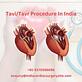 Tavi procedure cost in india in Foley, AL Health & Medical