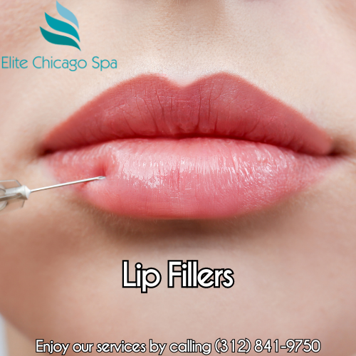 Lip Fillers Chicago Injections