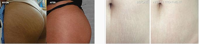 Product - Neoderma in Anaheim, CA Health & Medical