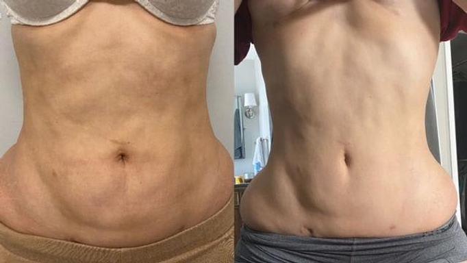 Product - Somatic Massage Therapy, P.C in Floral Park - Floral Park, NY Massage Therapy