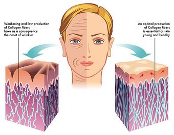 Product - BeautyFix Medspa East side in Upper Eastside - New York, NY Day Spas