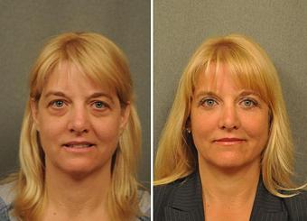 Product - Changes Plastic Surgery & Spa in San Diego, CA Physicians & Surgeons Plastic Surgery