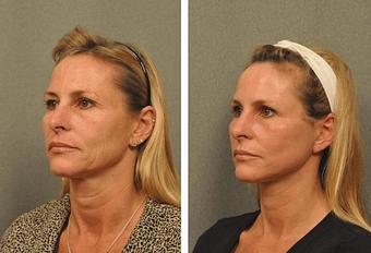 Product - Changes Plastic Surgery & Spa in San Diego, CA Physicians & Surgeons Plastic Surgery