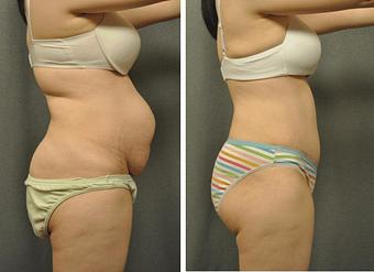 Product - Changes Plastic Surgery & Spa in San Diego, CA Physicians & Surgeons Plastic Surgery