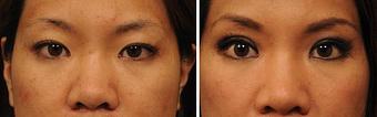 Product - Changes Plastic Surgery & Spa in San Diego, CA Physicians & Surgeons Plastic Surgery