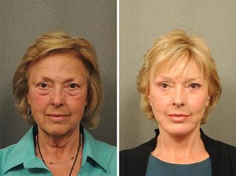 Product - Changes Plastic Surgery & Spa in San Diego, CA Physicians & Surgeons Plastic Surgery