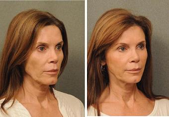 Product - Changes Plastic Surgery & Spa in San Diego, CA Physicians & Surgeons Plastic Surgery