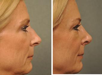 Product - Changes Plastic Surgery & Spa in San Diego, CA Physicians & Surgeons Plastic Surgery