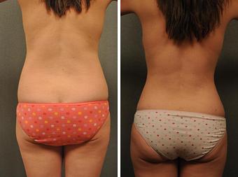 Product - Changes Plastic Surgery & Spa in San Diego, CA Physicians & Surgeons Plastic Surgery