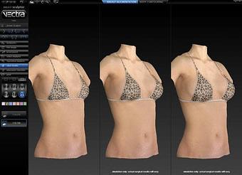 Product - Changes Plastic Surgery & Spa in San Diego, CA Physicians & Surgeons Plastic Surgery
