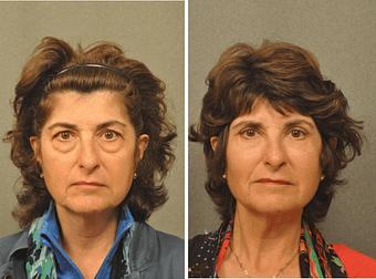 Product - Changes Plastic Surgery & Spa in San Diego, CA Physicians & Surgeons Plastic Surgery