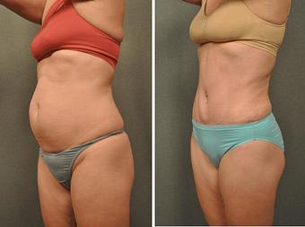 Product - Changes Plastic Surgery & Spa in San Diego, CA Physicians & Surgeons Plastic Surgery