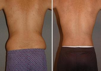 Product - Changes Plastic Surgery & Spa in San Diego, CA Physicians & Surgeons Plastic Surgery