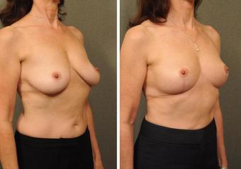 Product - Changes Plastic Surgery & Spa in San Diego, CA Physicians & Surgeons Plastic Surgery