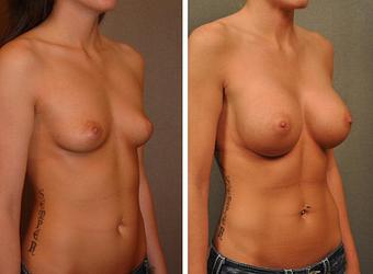 Product - Changes Plastic Surgery & Spa in San Diego, CA Physicians & Surgeons Plastic Surgery