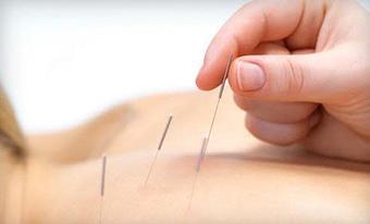 Product - City Acupuncture in New York, NY Acupressure & Acupuncture Specialists