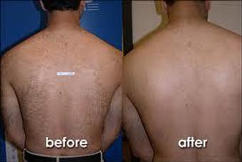 Product - Fusion Medispa in Odessa, FL Day Spas