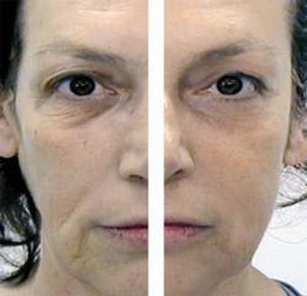Product - Fusion Medispa in Odessa, FL Day Spas