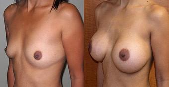 Product - Gulf Coast Plastic Surgery - Lake Jackson in Lake Jackson, TX Physicians & Surgeons Plastic Surgery Product - Gulf Coast Plastic Surgery - Lake Jackson in Lake Jackson, TX Physicians & Surgeons Plastic Surgery