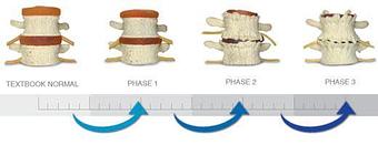 Product - HealthWorks Chiropractic in Macomb, MI Chiropractor