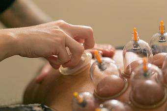 Product: Get Cupped Up! - IMR Massage in Las Vegas, NV Massage Therapy
