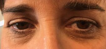 Product - Lash Lounge & Spa in Palm Harbor, FL Day Spas