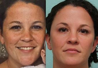 Product - LeBeau Clinic in Pensacola, FL Clinics
