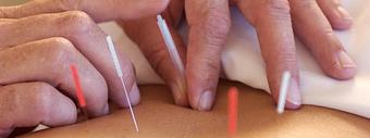 Product - Lotus Acupuncture & Holistic Health Clinic in Virginia Beach, VA Clinics