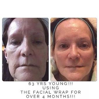 Product: Those results reflect using our facials for 4 months. - Main Street Hair Company in Lisle, IL Barber Shops