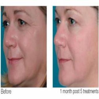 Product - Metamorphosis Day Spa in Midtown East - New York, NY Day Spas Product - Metamorphosis Day Spa in Midtown East - New York, NY Day Spas