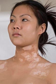 Product - Microskin New York in New York, NY Day Spas