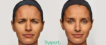 Product - Neoderma in Anaheim, CA Health & Medical