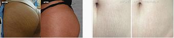 Product - Neoderma in Anaheim, CA Health & Medical